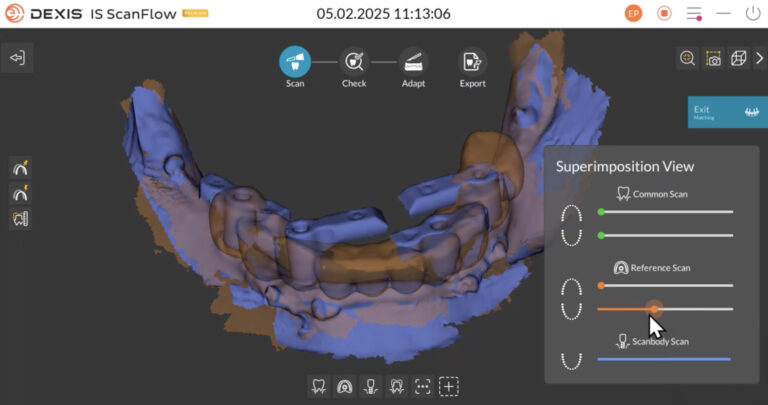 Cyfrowe szkolenie stomatologiczne – lekarz prezentuje planowanie leczenia na monitorze podczas kursu Digital Dental Education.